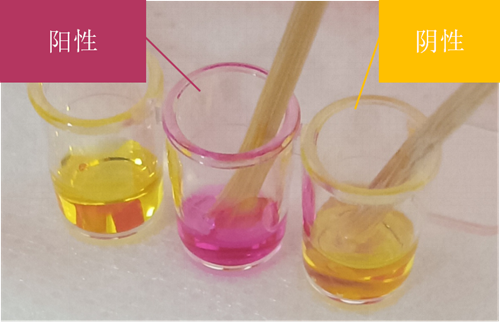 感染幽门螺杆菌，9岁男孩连续数月腹部不适和干呕休闲区蓝鸢梦想 - Www.slyday.coM