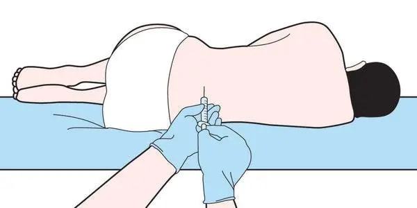 小儿推拿杨晓为什么要做腰椎穿刺给孩子做腰穿有哪些常见问题