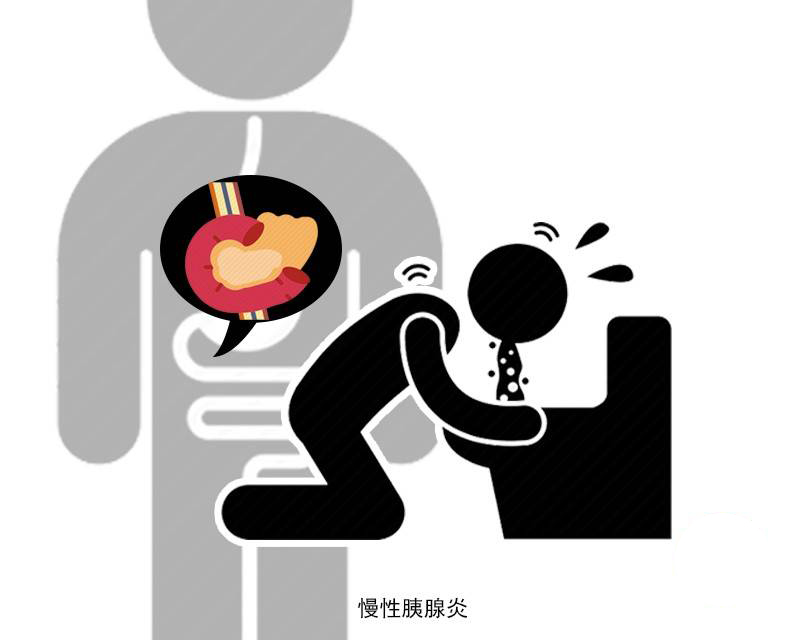 胰腺癌一发现都是中晚期?这4个表现早就暗示过,可惜很多人无视休闲区蓝鸢梦想 - Www.slyday.coM 胰腺癌一发现都是中晚期?这4个表现早就暗示过,可惜很多人无视休闲区蓝鸢梦想 - Www.slyday.coM