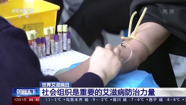 低流行水平！我国报告现存艾滋病感染者114万例休闲区蓝鸢梦想 - Www.slyday.coM