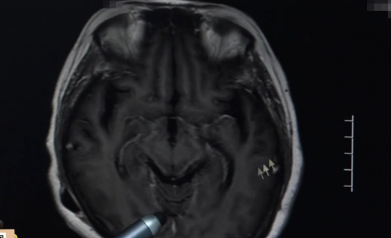 吃了冰箱里的炒鸡饭，女子高烧不退险丧命？警惕这个“冰箱杀手”休闲区蓝鸢梦想 - Www.slyday.coM