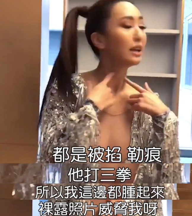 女明星蔷蔷曾遭男友暴打!被掐脖子打肿脸,一怒之下锤烂对方电脑休闲区蓝鸢梦想 - Www.slyday.coM 女明星蔷蔷曾遭男友暴打!被掐脖子打肿脸,一怒之下锤烂对方电脑休闲区蓝鸢梦想 - Www.slyday.coM