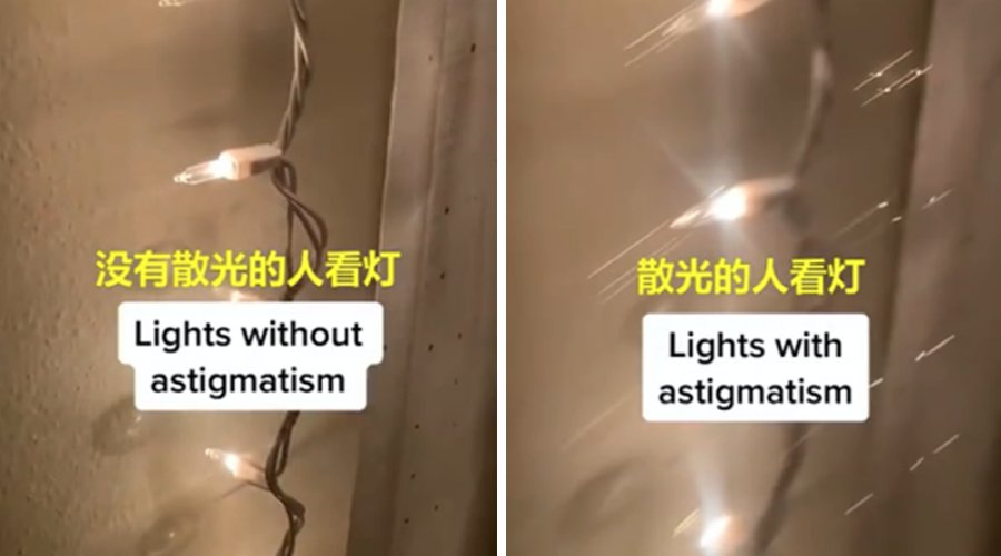 转换到真实世界里,如果说正常的眼睛看到的是几个小灯泡,那么散光的人