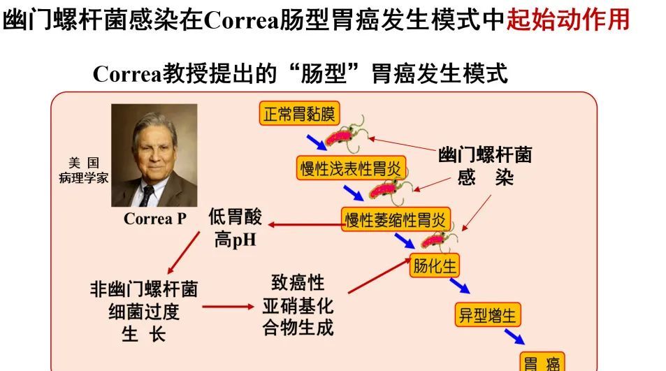 预防和管控幽门螺杆菌就是预防胃癌
