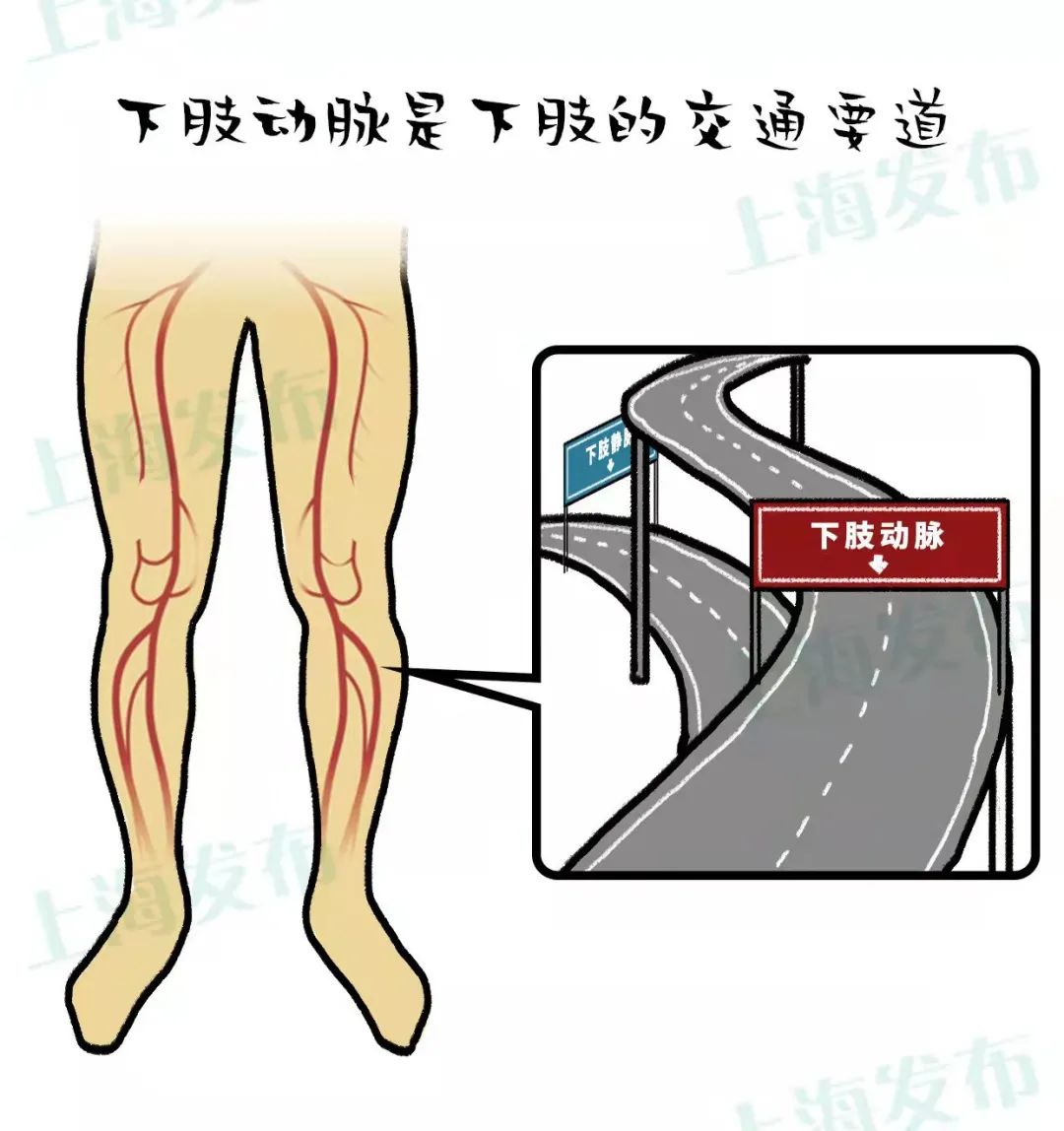 医聊40岁以上中老年人腿脚不便警惕下肢动脉血管