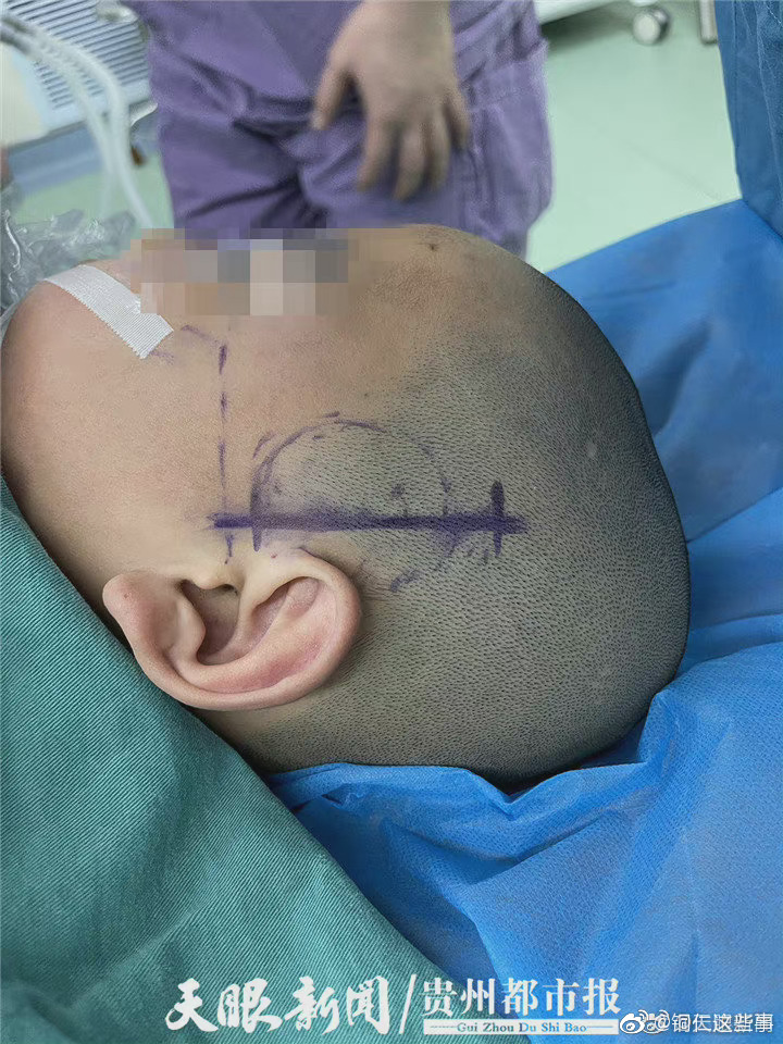 贵州一9岁男孩一天昏迷多达10余次 每次昏迷短则一分钟长则三四分钟！休闲区蓝鸢梦想 - Www.slyday.coM