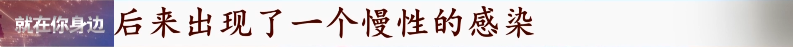 提醒！女子连续一个月咳嗽，吃药也不见好，医生发现肺部竟长满......休闲区蓝鸢梦想 - Www.slyday.coM