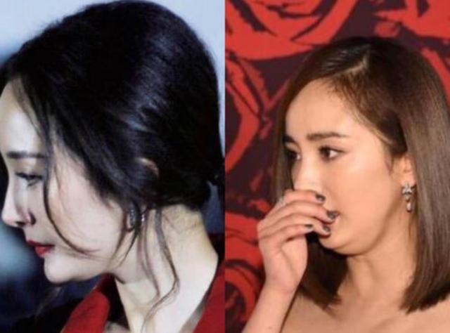 下巴两侧也多了几道纹路,两颊脂肪有些下垂,还有点瘪嘴.