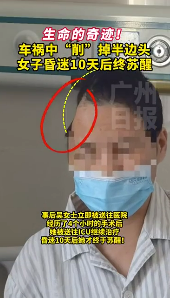 广东一女子出车祸被削掉半边头，昏迷十天奇迹生还！休闲区蓝鸢梦想 - Www.slyday.coM