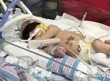 爸爸用嘴给感冒女儿吸鼻涕，感动死了妈妈和媒体人，却不知，这样做很可能会害死宝宝！休闲区蓝鸢梦想 - Www.slyday.coM