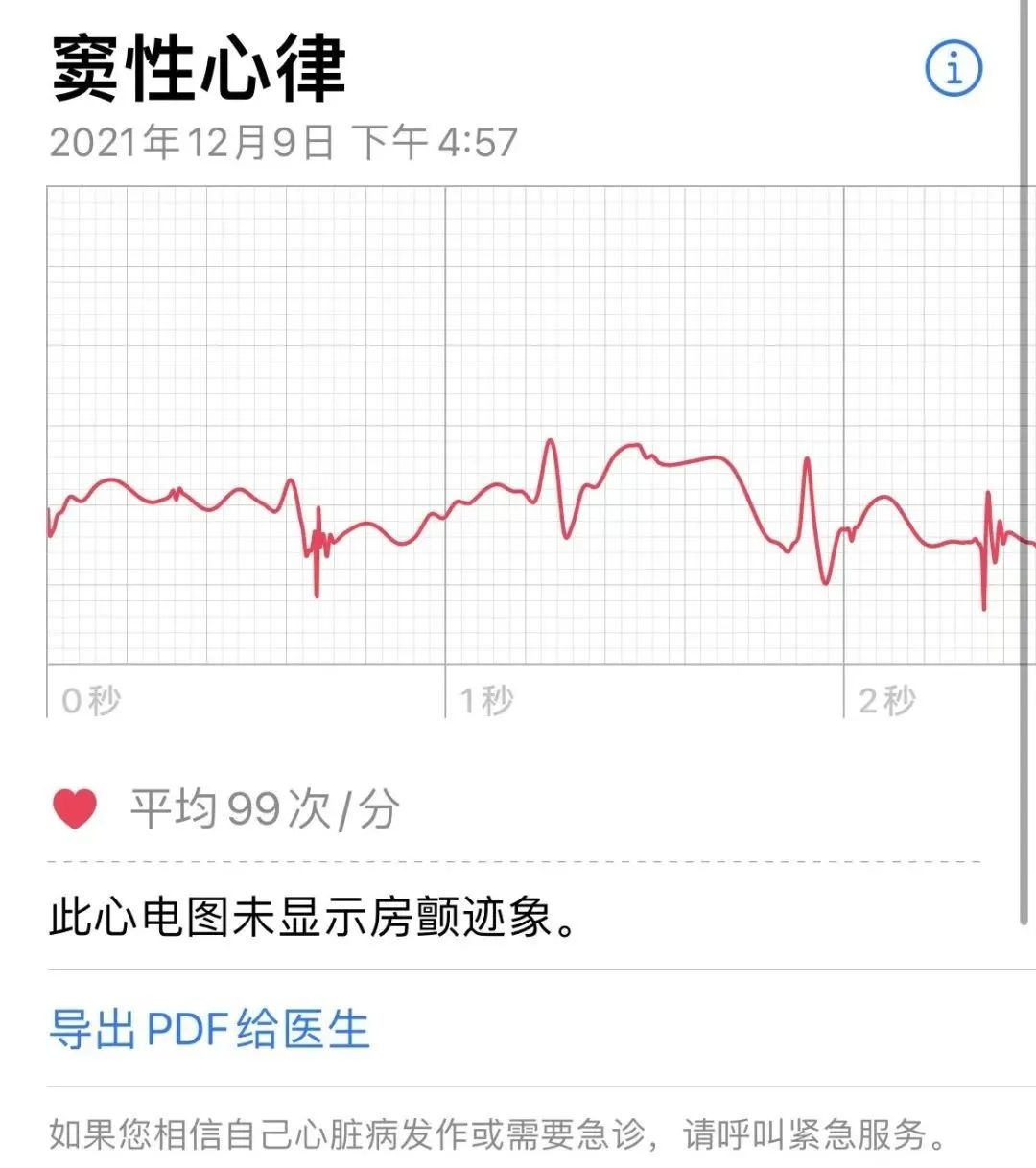时隔三年苹果手表心电图功能解锁支持4款机型快来看你的能不能用