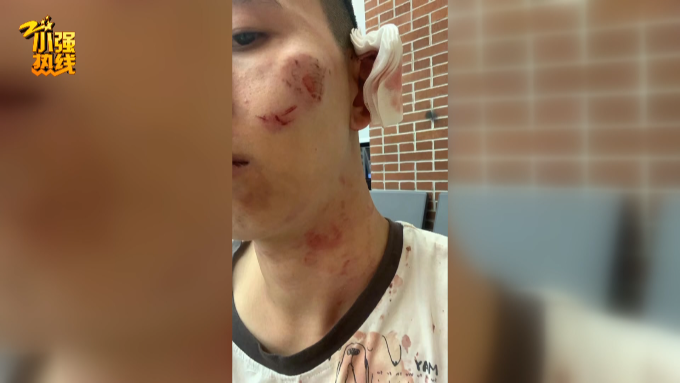 男子开车出门被陌生人咬了十几口，内裤都被撕破，真相太意外…【930新闻眼】休闲区蓝鸢梦想 - Www.slyday.coM