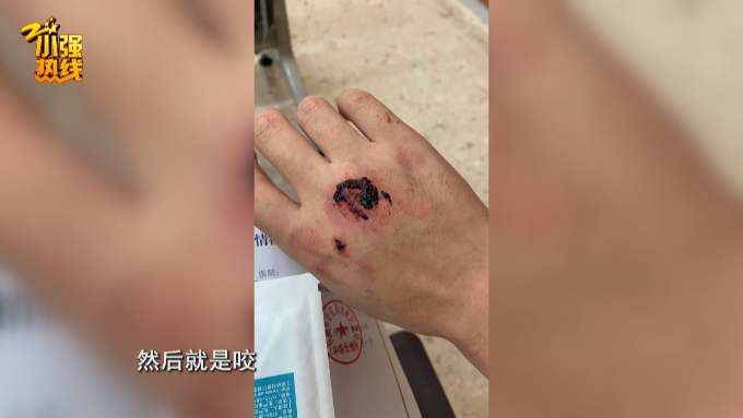 男子开车出门被陌生人咬了十几口，内裤都被撕破，真相太意外…【930新闻眼】休闲区蓝鸢梦想 - Www.slyday.coM