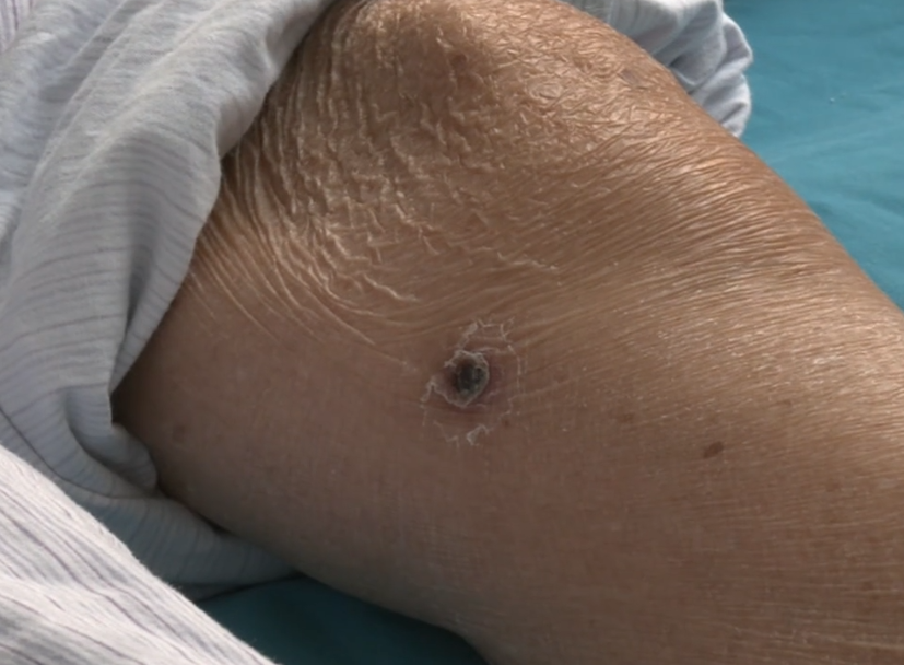 寄主但这样兜兜转转都会染上恙虫病所以喜欢撸猫的朋友一定要更加小心