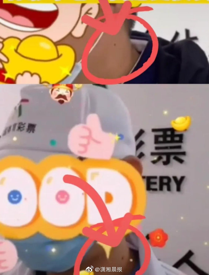 “痣”同道合？海南体彩回应2位大奖得主同一位置有黑痣休闲区蓝鸢梦想 - Www.slyday.coM