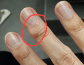 中指,虽然长大后写字机会少,老茧渐渐消退了,但骨节常年被压迫,手指