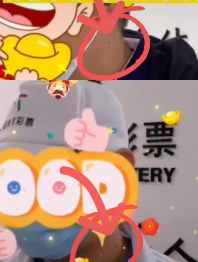 “痣”同道合？海南体彩回应两位大奖得主脖子同一位置有黑痣休闲区蓝鸢梦想 - Www.slyday.coM