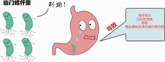 一人得病染全家！一级致癌物幽门螺杆菌有多可怕，究竟该咋预防？休闲区蓝鸢梦想 - Www.slyday.coM