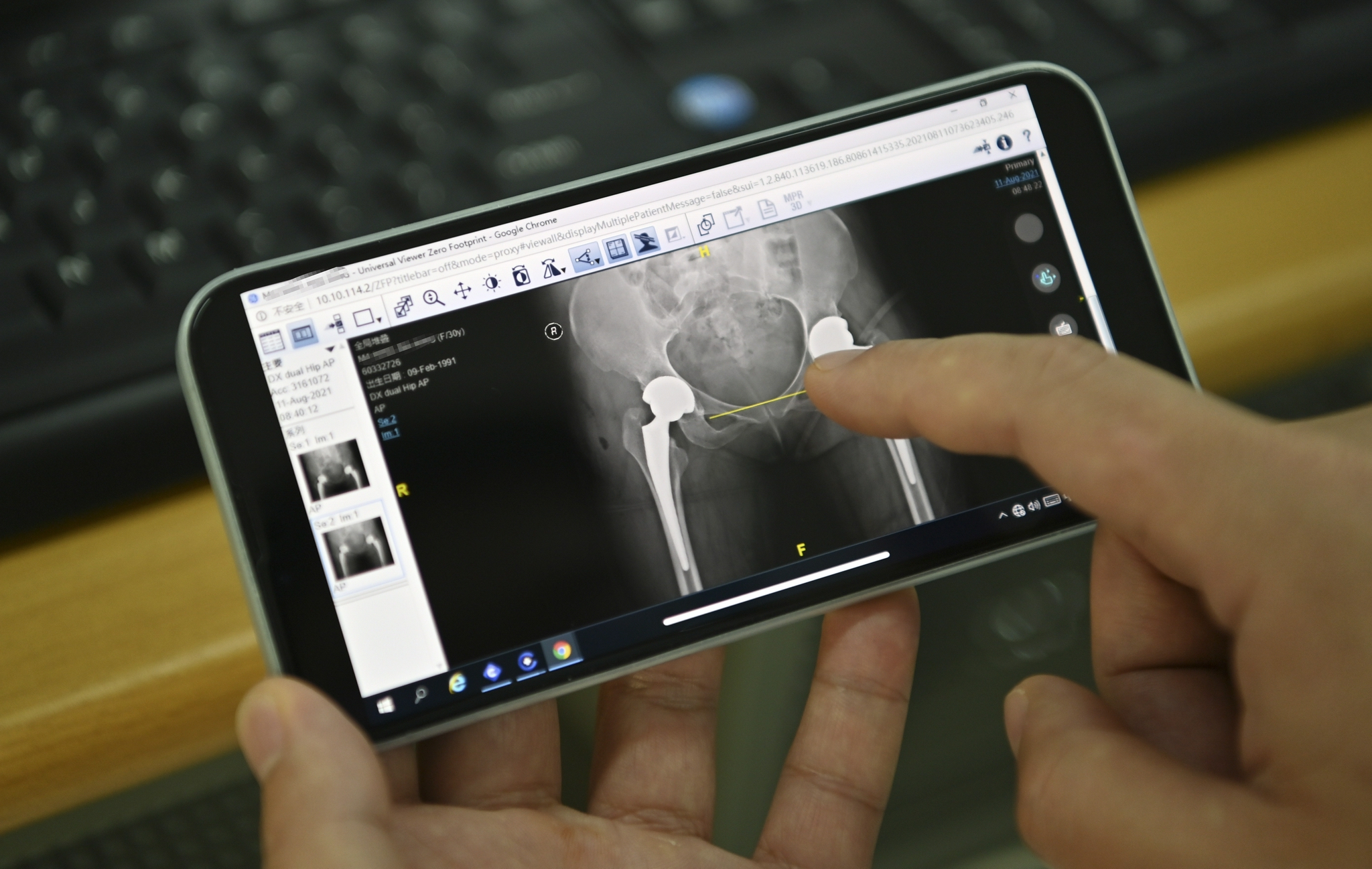 数字胶片云影像智慧医疗再上新