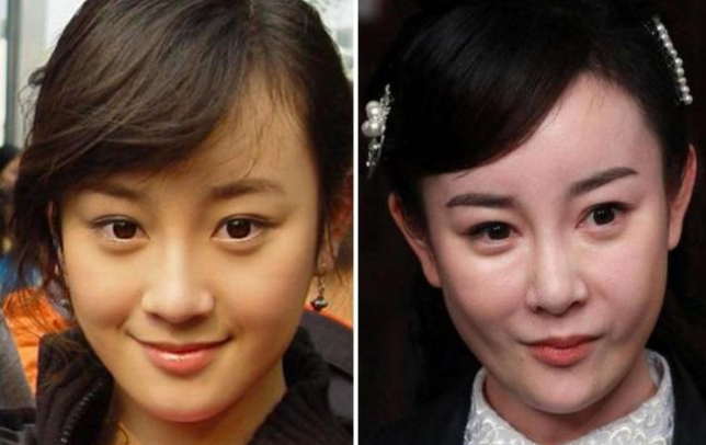 整容塌房的女明星一个比一个不自然后遗症让她们脸型怪异