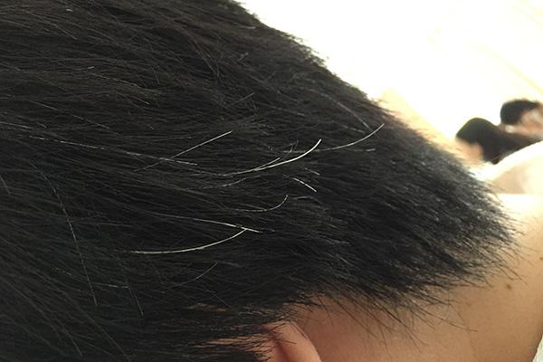 莫名长出白发，怎么办？别急着染发，做好3件事，或许还能黑回来休闲区蓝鸢梦想 - Www.slyday.coM