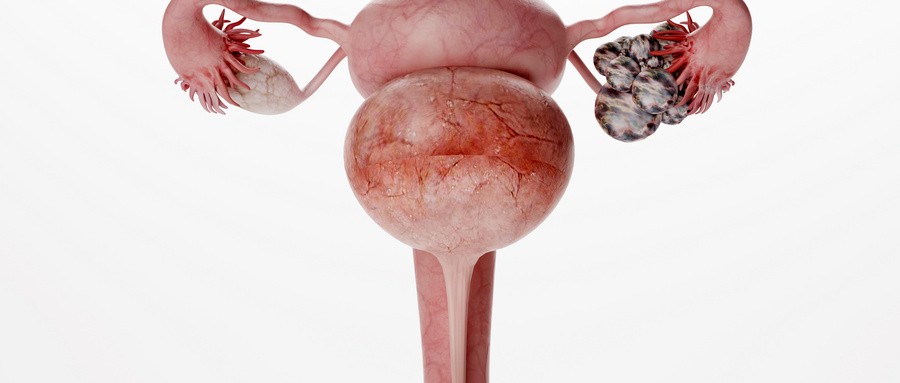 太原中山生殖医院巧克力囊肿的孕育之苦