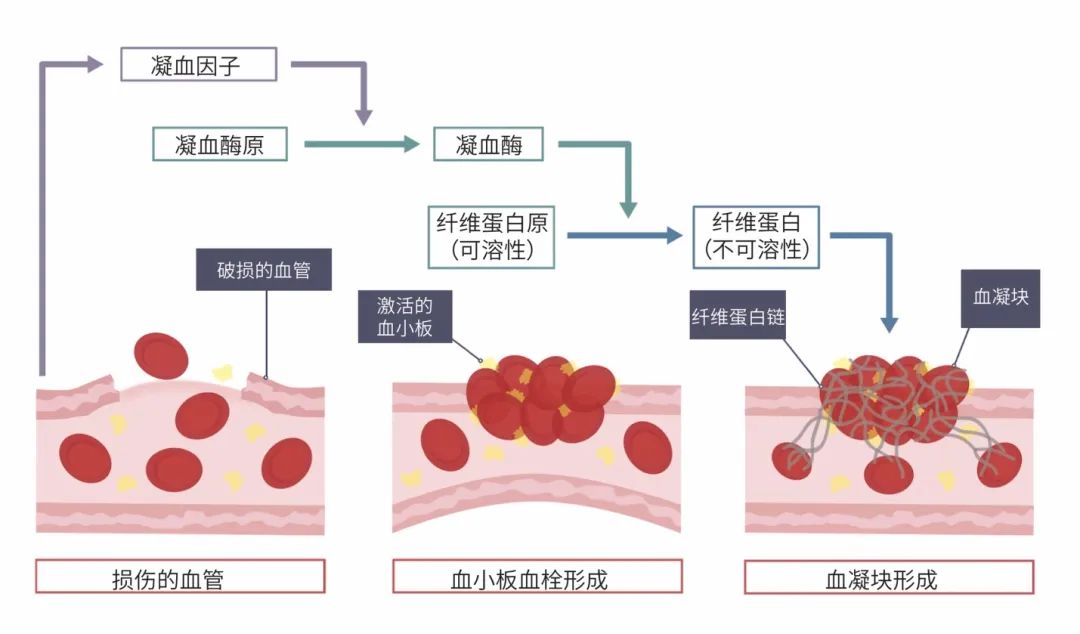 在凝血酶的催化下,血液中原本可溶性的纤维蛋白原转变为不可溶的纤维