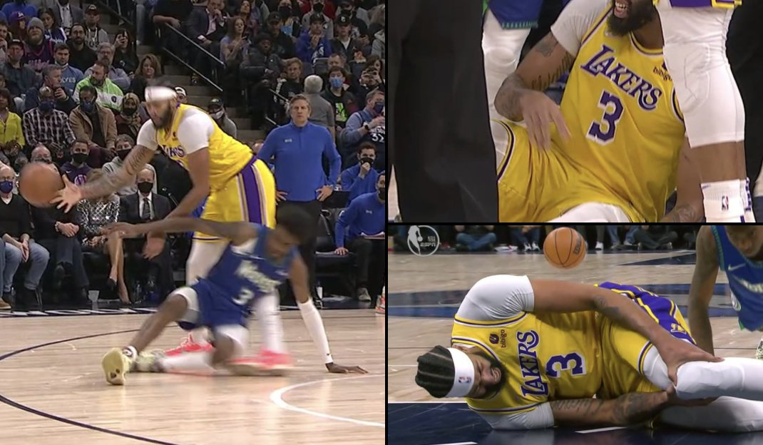 戴维斯左膝被压受伤再次返回更衣室