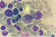 “西安出现多例出血热”顶上热搜！这是种什么病？休闲区蓝鸢梦想 - Www.slyday.coM