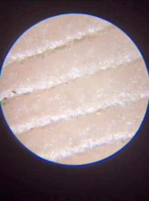 纹路|显微镜|细菌_新浪新闻