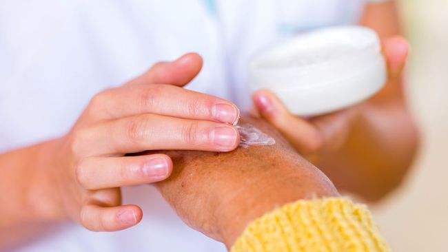 银屑病治疗方法