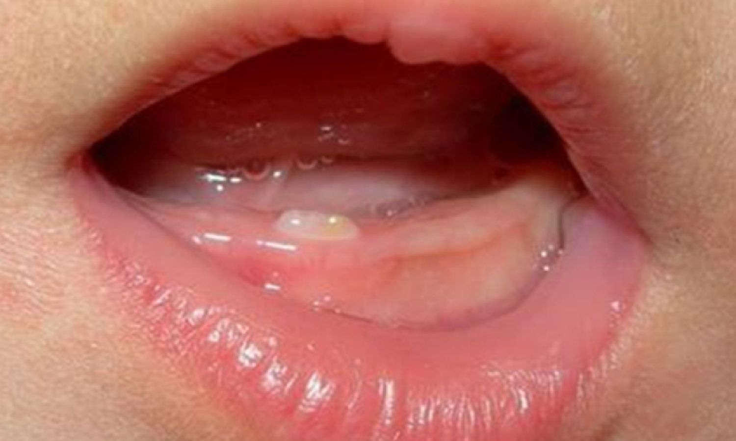 孩子长牙的那些事时间表现以及如何满足需求爸妈们看过来