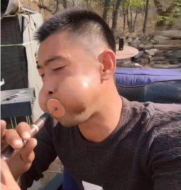 男子因常年吹奏唢呐腮帮形状异于常人人们一见到就忍不住大笑