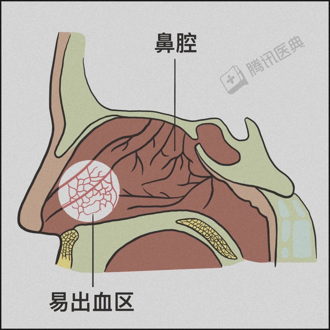 这个方法适用于鼻腔前部出血的人.