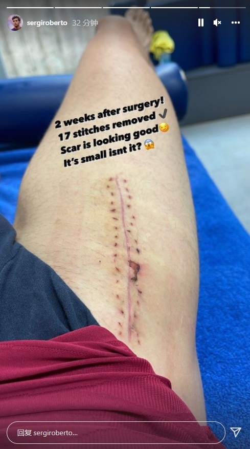 12月10日罗贝托接受了右大腿股直肌手术,预计要等到明年3月底