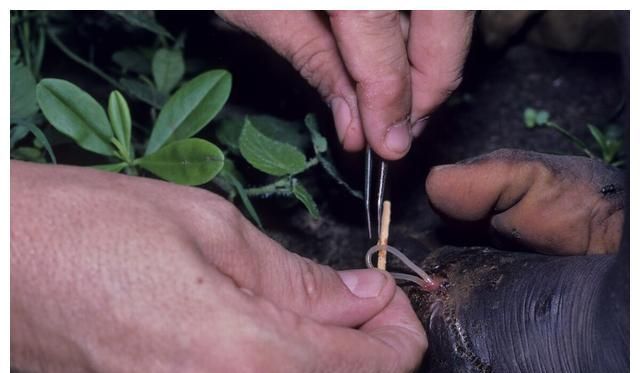 曾经让350万人痛苦不堪的寄生虫,长度分解出来竟有一米?__财经头条