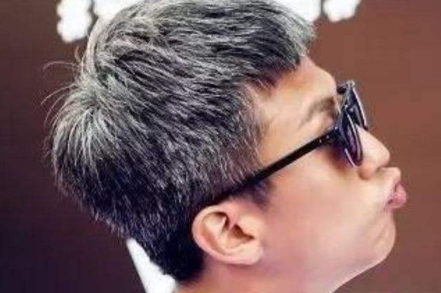 为什么白头发越长越多你以为是老了医生或是缺乏2种营养素