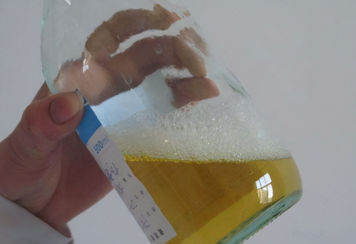 45岁大姐小便异样查出糖尿病医生祸首找到了劝你别再多喝