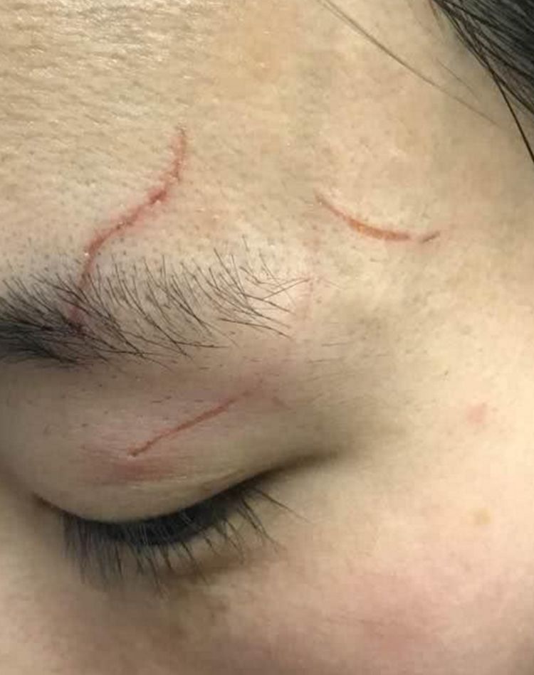 猫咪半夜被噩梦惊醒胆战心惊之下抓伤了主人的脸主人懵了