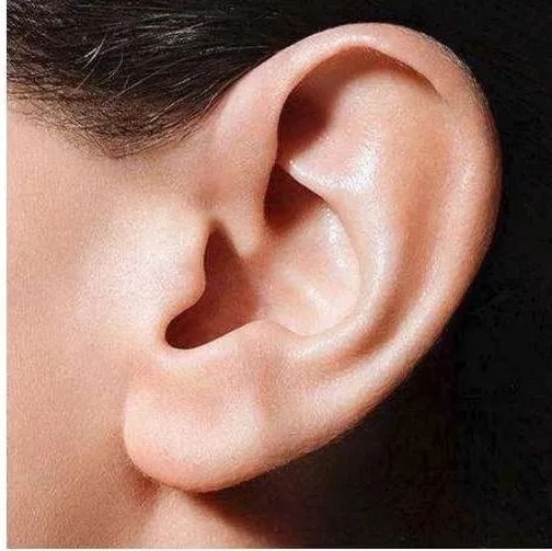 惊 | 招风耳"招财,更聪明"?医生:这是畸形耳!常见耳廓畸形有这些