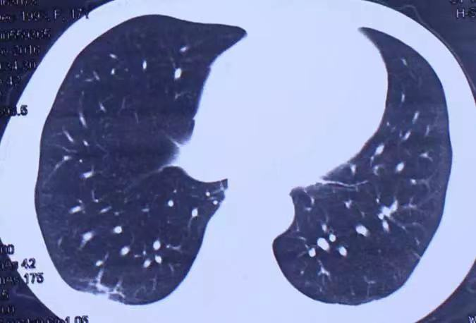 丧心病狂！18岁少女被姐夫投毒，稀释后的百草枯可以“洗”掉吗？休闲区蓝鸢梦想 - Www.slyday.coM