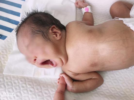 出生时仅1.4千克 南京市江宁医院成功救治一名29周极早产儿休闲区蓝鸢梦想 - Www.slyday.coM