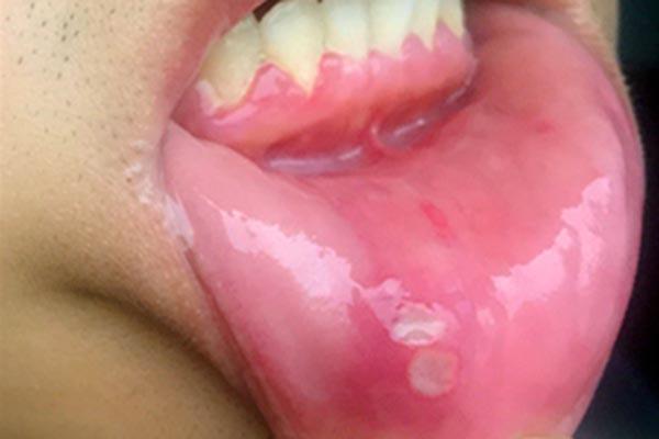 电热毯辐射大有致癌风险电热毯还能不能用了告诉你真相