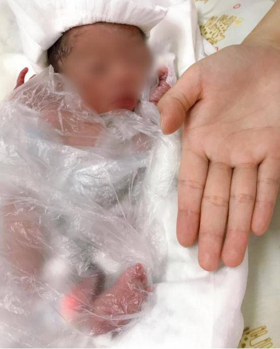 出生时仅1.4千克 南京市江宁医院成功救治一名29周极早产儿休闲区蓝鸢梦想 - Www.slyday.coM