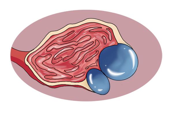 囊肿和肿瘤一字之差，有什么区别？囊肿会恶化成癌症吗？建议了解休闲区蓝鸢梦想 - Www.slyday.coM