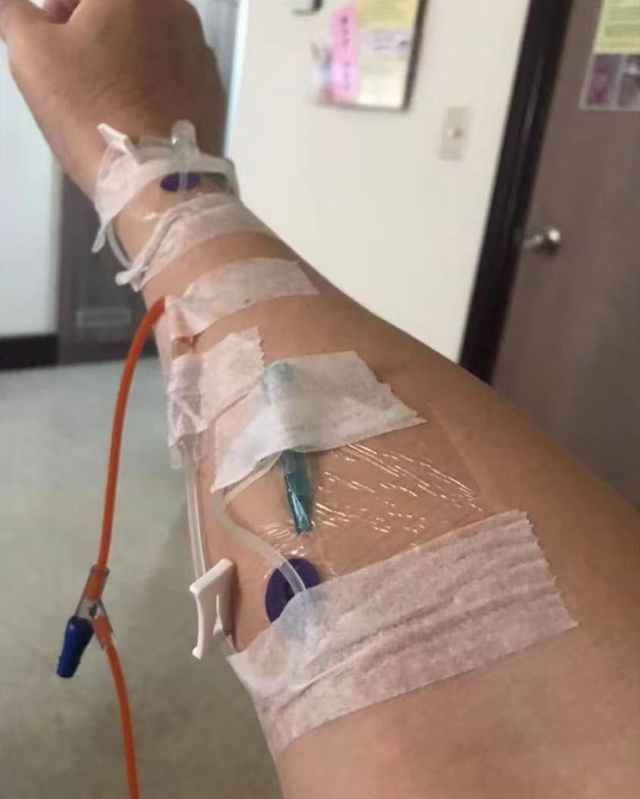 54岁张铭杰紧急入院突发心脏病心率140晒病床照手臂插满针管