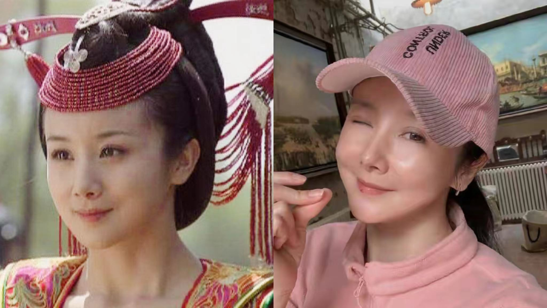 要说孙菲菲,她绝对是被整容坑的最惨的女明星之一.