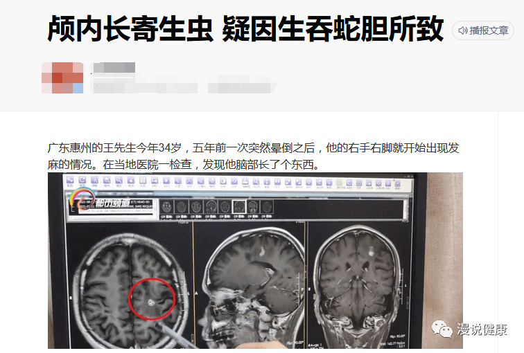 如果中毒情况明显,甚至会直接使人死亡.