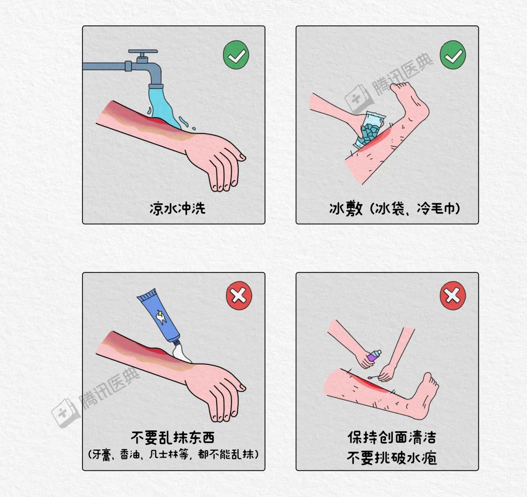 如果你不小心被低温烫伤,或者怀疑自己低温烫伤,也千万不要慌.
