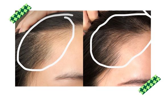 女生掉多少头发算脱发？看完有点慌休闲区蓝鸢梦想 - Www.slyday.coM